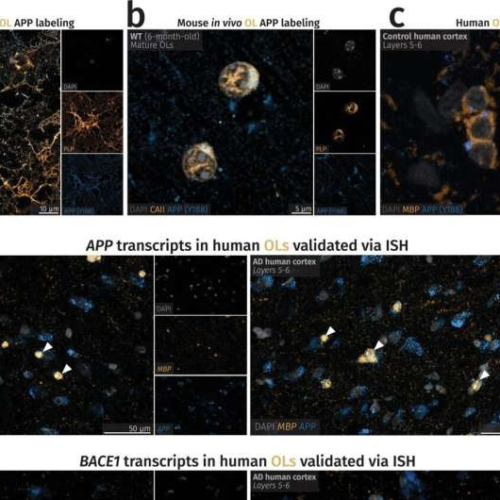 Alzheimer’s disease: It’s not only neurons—glial cells also produce harmful proteins