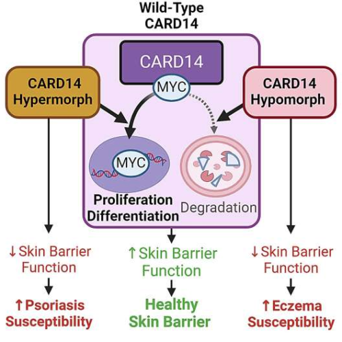 New findings on CARD14 protein’s role in eczema and psoriasis