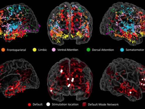 Neuroscientists identify brain network critical for creative idea generation