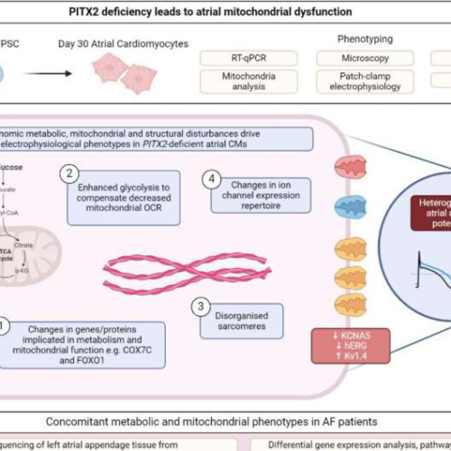 Gene-related metabolic dysfunction may be driving heart arrhythmia