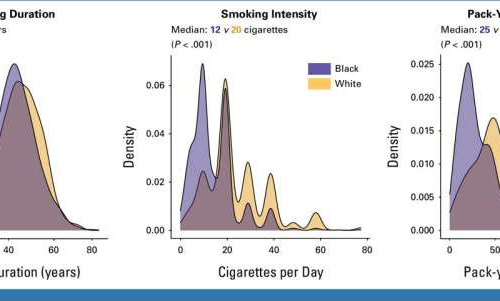 Proposed lung cancer screening guideline could eliminate racial disparities, allow for early detection