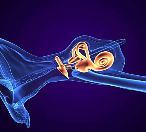 Vestibular neurectomy effective for Meniere disease