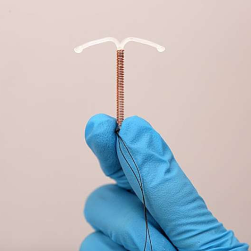 Many doctors underestimate the pain of IUD insertion for women—the CDC wants to change that