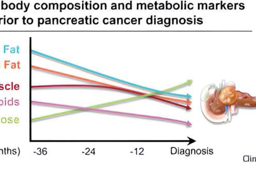 Detecting pancreatic cancer through changes in body composition and metabolism