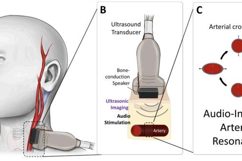 Continuous, noninvasive blood pressure monitoring using sound