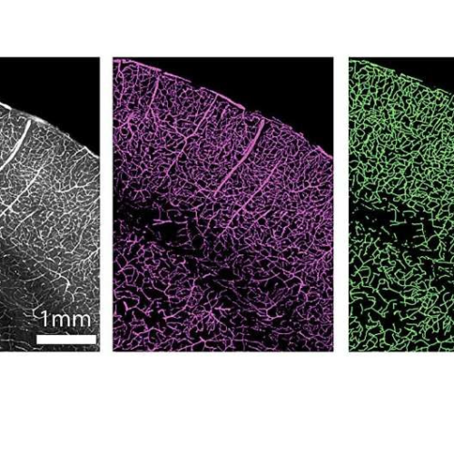 New high-resolution 3D maps show how the brain’s blood vessels change with age