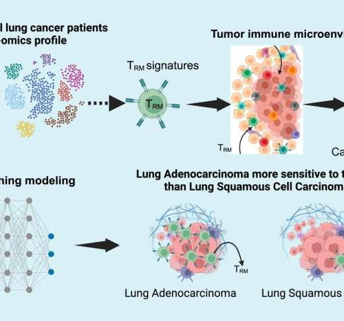 Recent study reveals key immune cells as critical factors in lung cancer prognosis