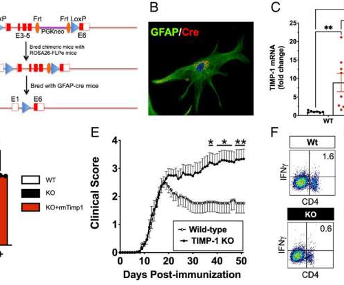 New work focuses on lack of TIMP-1 expression in the brains of MS patients