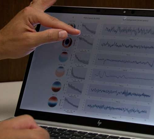 AI boosts the power of EEGs, enabling neurologists to quickly, precisely pinpoint signs of dementia