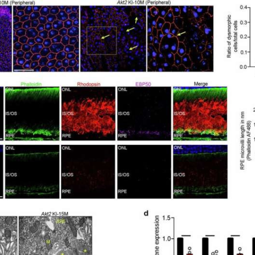 Researchers discover potential therapeutic target for degenerative eye disease