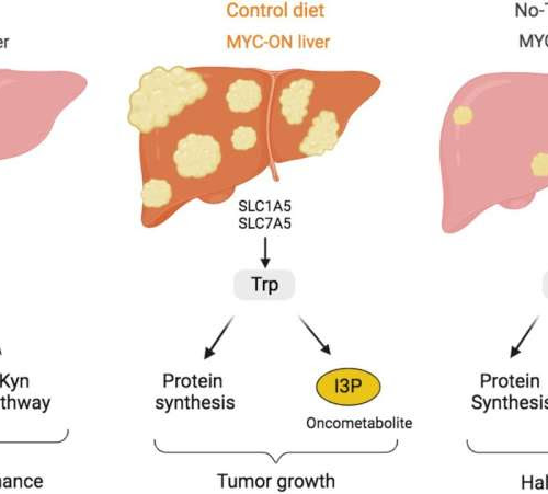 Liver cancer growth tied to tryptophan intake