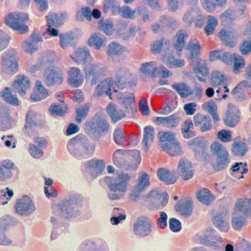 Blood stem cell research could transform bone marrow transplants