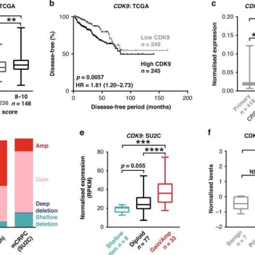 Proof-of-principle study uncovers promising treatment for incurable prostate cancer