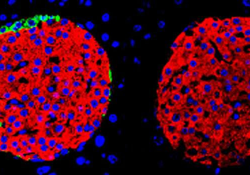 Beta cells alone can regulate blood sugar levels, study finds