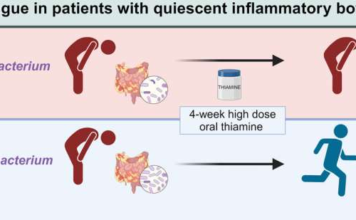 Vitamin B1 linked to reduced fatigue in some inflammatory bowel disease patients