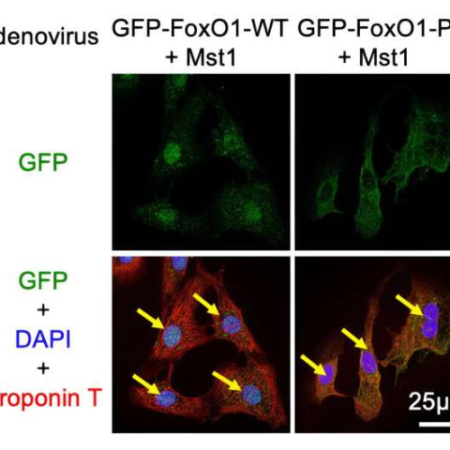 New avenues for treating heart failure: Uncovering a protective mechanism in cardiac myocytes