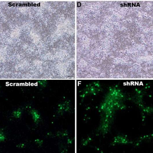 RNA treatment shows promise for enhancing memory and reducing anxiety