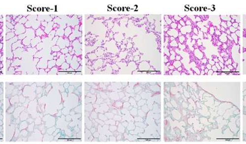 Quantitative ultrasound parameters offer new tool for diagnosing lung disease