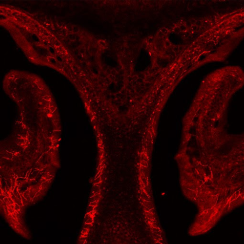 Cough or sneeze? How the brain knows what to unleash