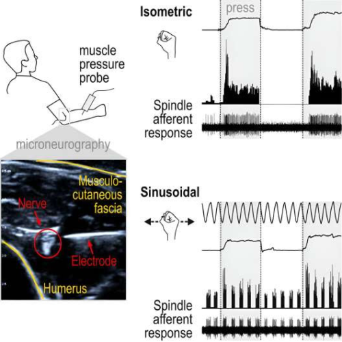 Pressure sensing by muscles provides a promising new target for treatments