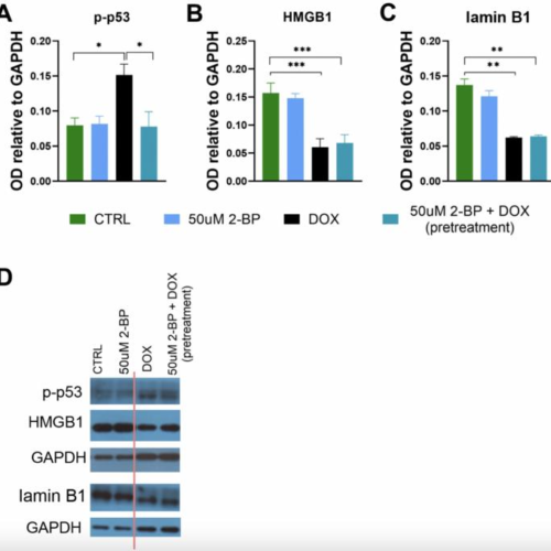 2-bromopalmitate reduces senescence in human cells: Role of palmitoylation