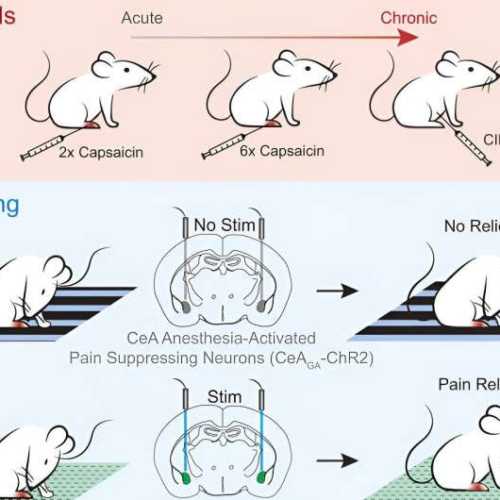 Harnessing the power of placebo for pain relief: Study investigates neural circuits linked to effect