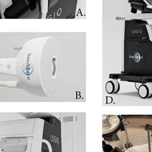 New noninvasive technique provides effective treatment for urinary stones