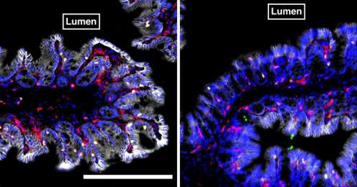 Gut microbiome found to influence location of immune cells