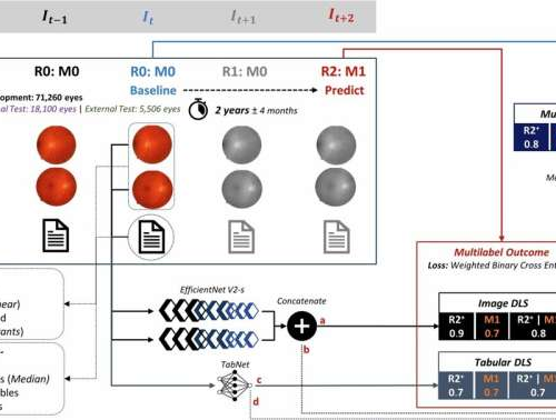 AI tool uses eye imaging datasets to optimize diabetic eye screening