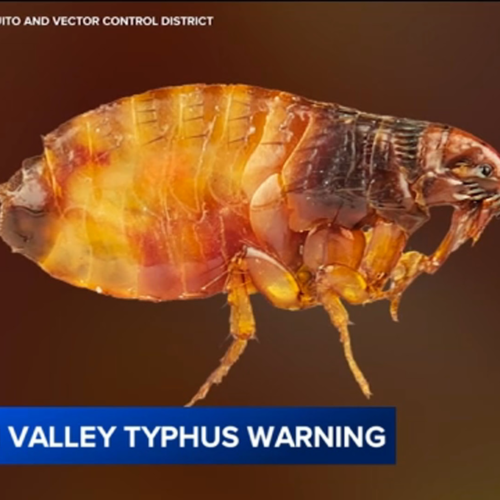 5th human case of flea-borne typhus reported in Orange County