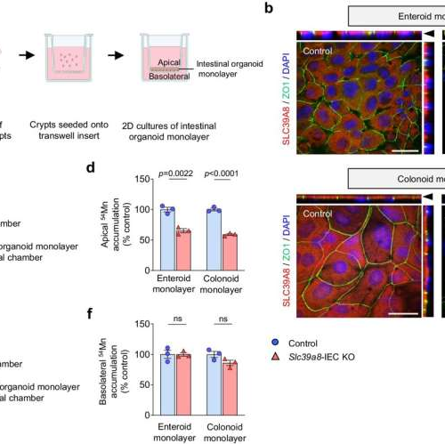 Gut reaction: Low levels of manganese can aggravate inflammatory bowel disease