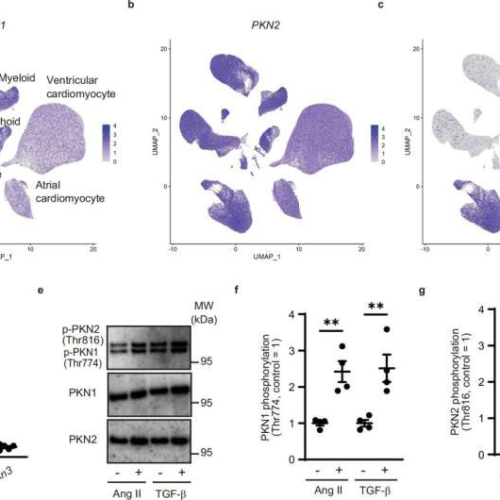 Researchers discover new target for treating heart failure: Protein kinase N