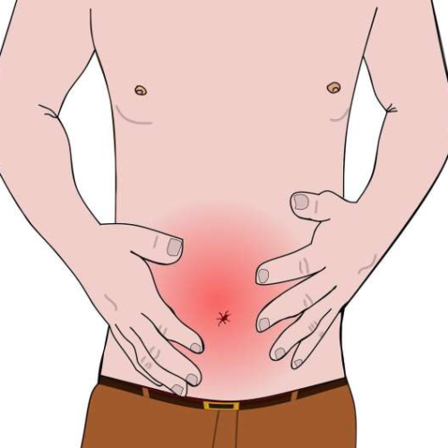 Updated guidelines published for evaluating and managing chronic constipation