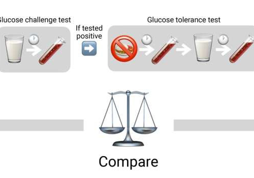 Study shows widely used test for gestational diabetes misses 70% of cases