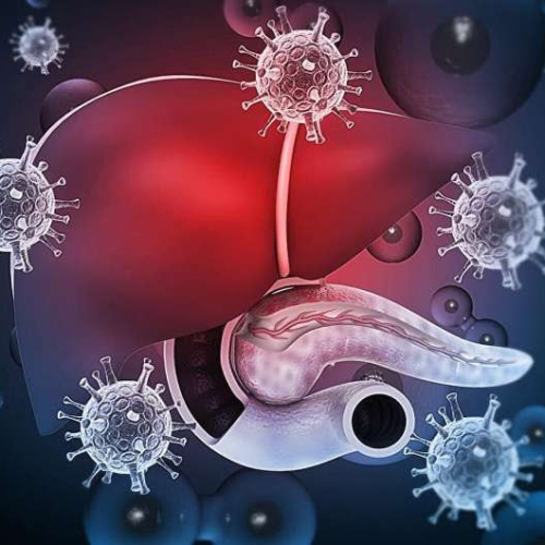 Model can predict, stratify liver cancer risk in noncirrhotic chronic hepatitis B