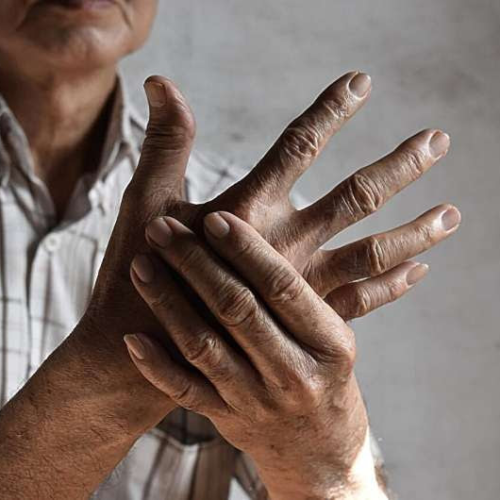 Arthritis can flare up in colder weather: Tips to easing the pain