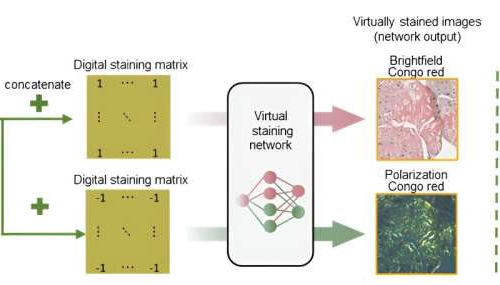 AI-based tissue staining can detect amyloid deposits without chemical stains or polarization microscopy