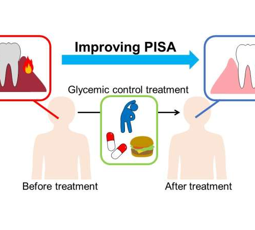 Research reveals that intensive treatment for diabetes can reduces gum disease inflammation