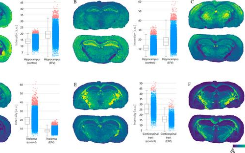 New study increases understanding of HIV drug’s negative effects on the brain