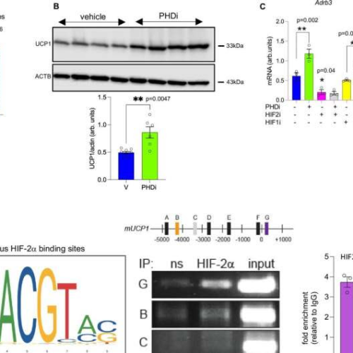 Removing gene from fat tissue tricks body into burning more calories, study suggests