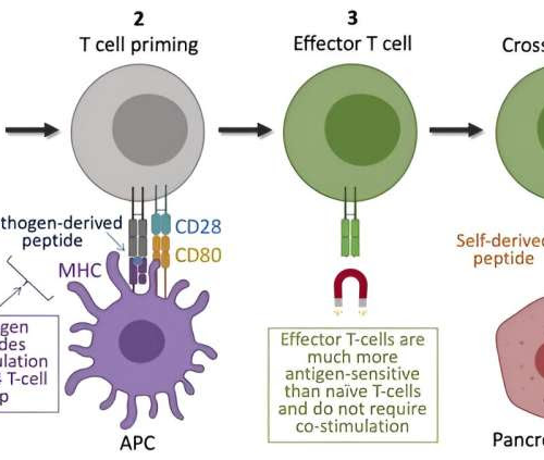 Bacterial infections could be trigger for type 1 diabetes, new research suggests