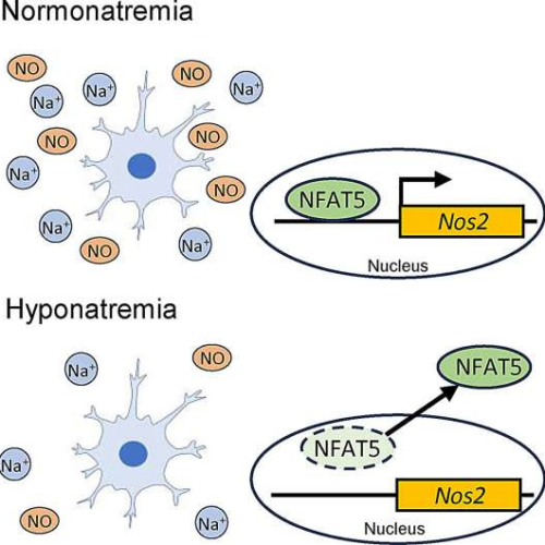 Exploring the effect of low sodium concentrations on brain microglial cells