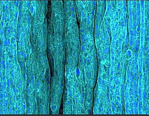 The mystery of human wrinkles: what do the cells say?