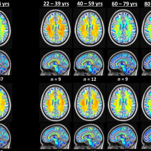 Brain training: Study links cardiovascular fitness to brain health