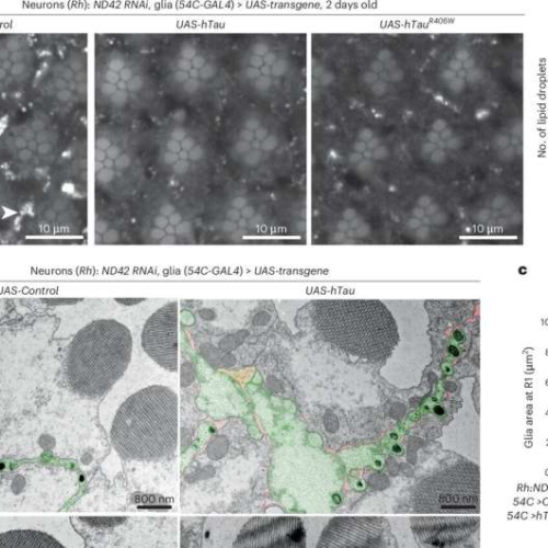 Not just a ‘bad guy’: Researchers discover neuroprotective function of Tau protein