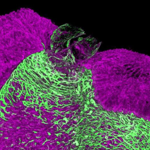 New clues on how the heart makes arteries