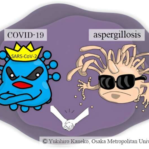 Analysis sheds light on COVID-19-associated disease in Japan