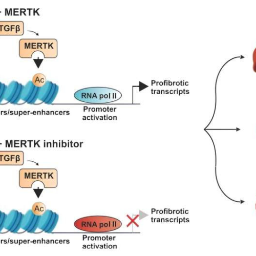 Fibrosis lacks treatments and methods of reversal: Study pinpoints a promising target for drug therapy