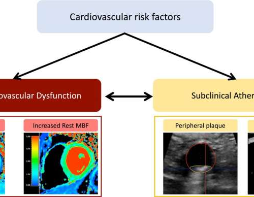 Cardiometabolic risk factors in apparently healthy individuals linked to altered coronary microcirculation