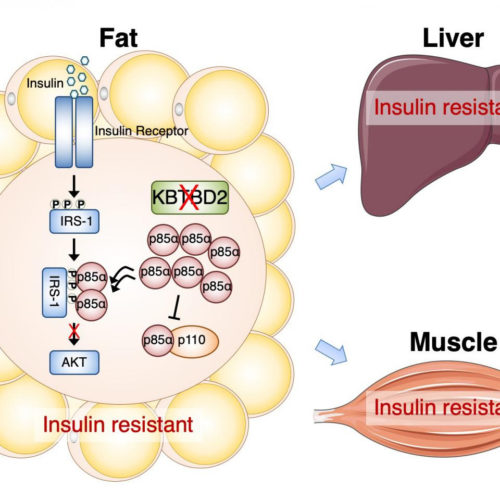Gene in fat plays key role in insulin resistance